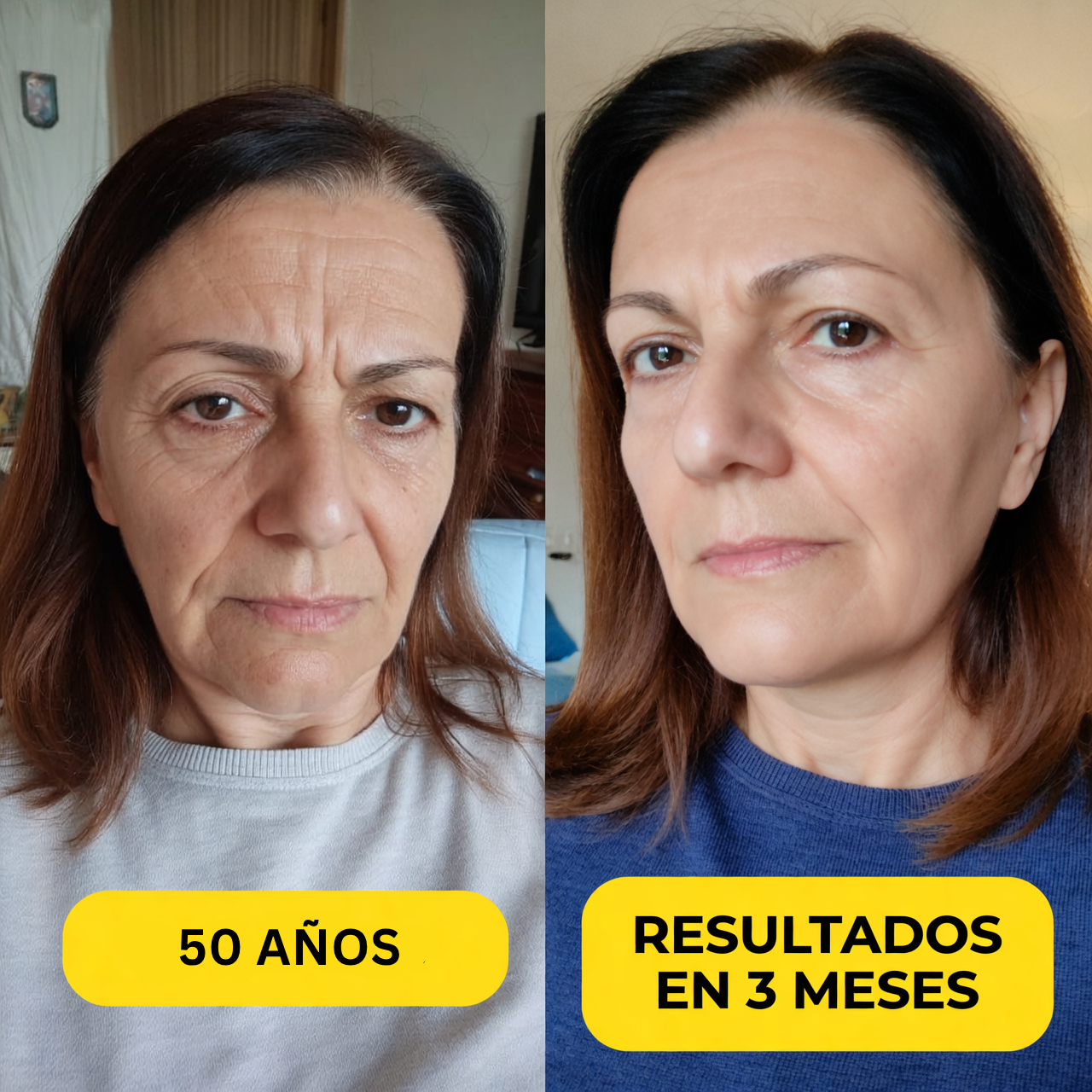 Resultado 50 años